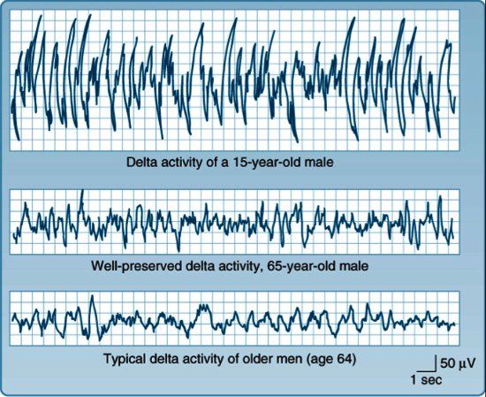 Graph showing lower amplitude delta waves in elderly